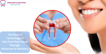 Painfree Root Canal Treatment