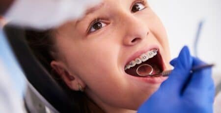 teeth Aligners treatment in Noida