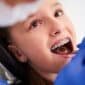 teeth Aligners treatment in Noida