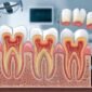 root canal specialist in Noida